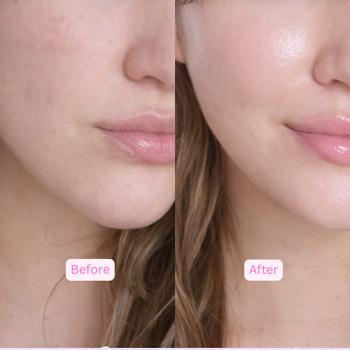 Overnight Collagen Wrap Mask